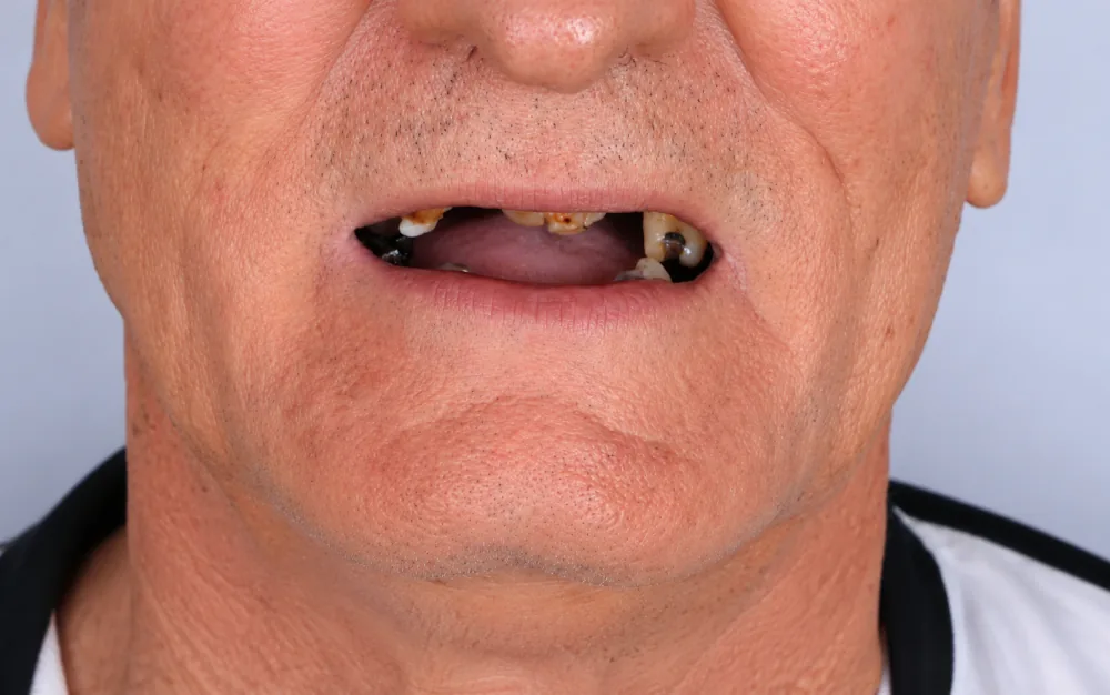 Mais um caso de sorriso antes do tratamento
